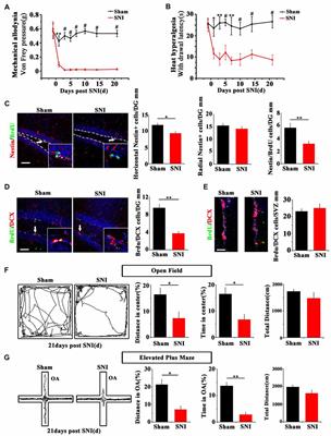 Anxiety Specific Response and Contribution of Active Hippocampal Neural Stem Cells to Chronic Pain Through Wnt/β-Catenin Signaling in Mice